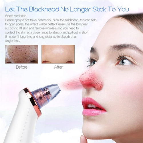 Vacuum Blackhead Remover Pimple Acne Removal Tool Skin Care Pore Pure Faze Health & Beauty