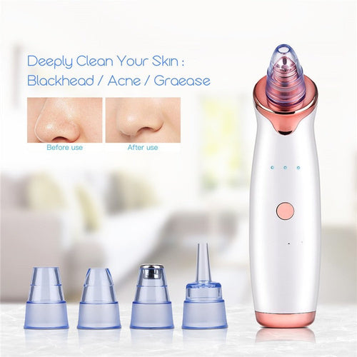 Vacuum Blackhead Remover Pimple Acne Removal Tool Skin Care Pore Pure Faze Health & Beauty